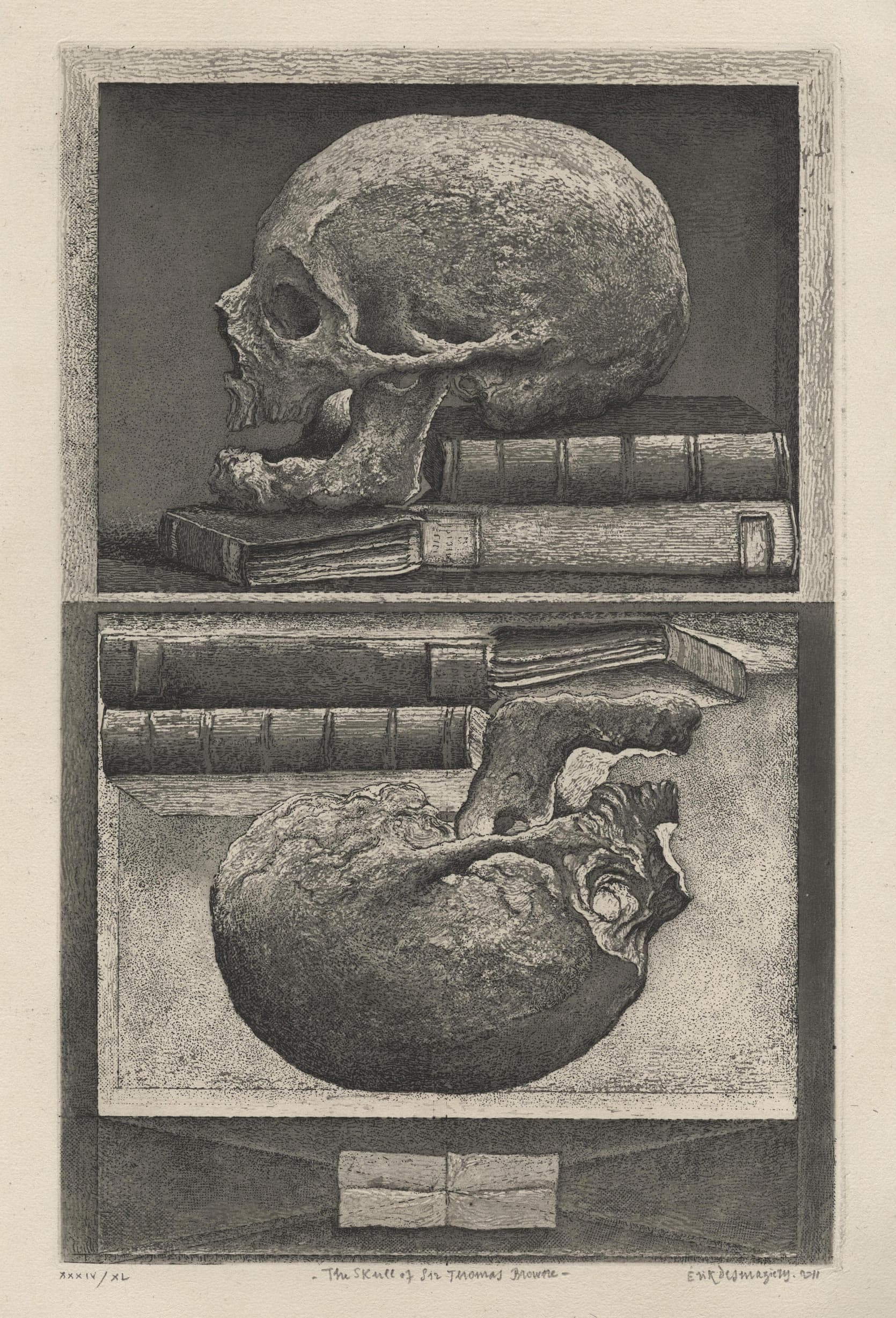 The skull of Sir Thomas Browne